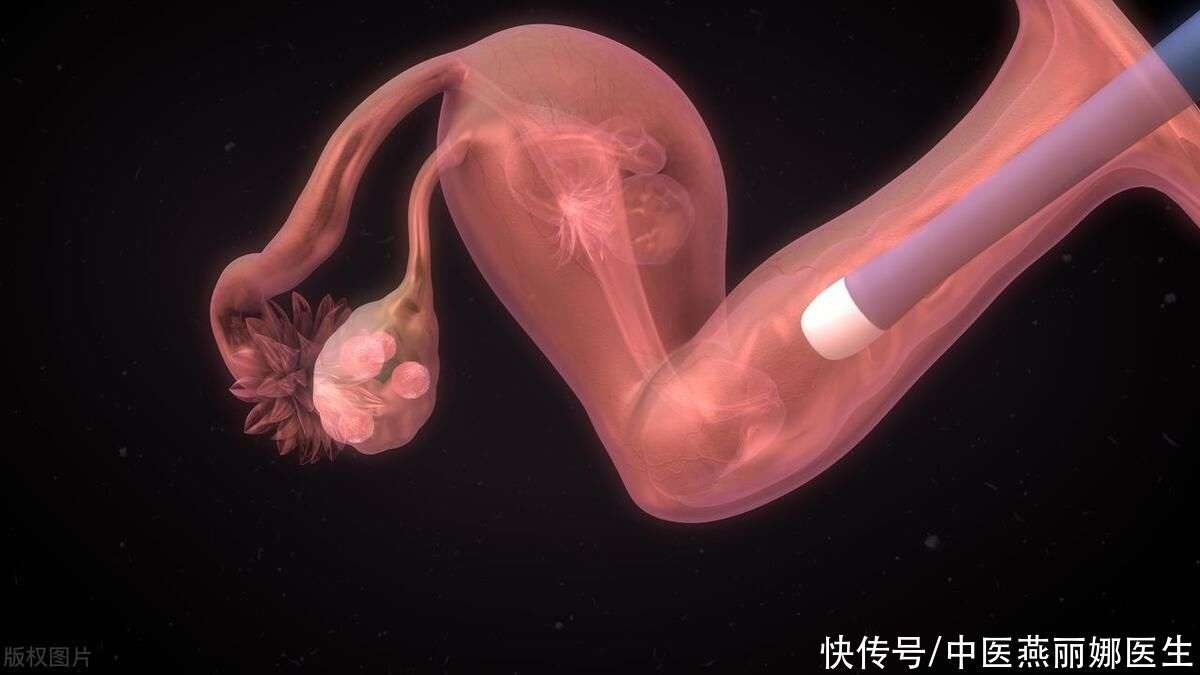人工受孕