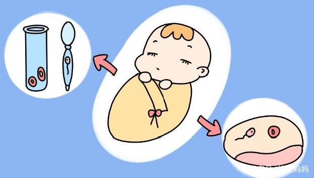 人工授精