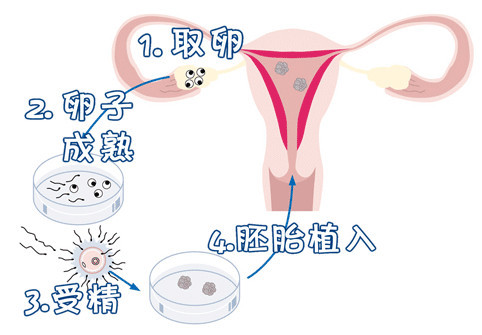 人工助孕沧州
