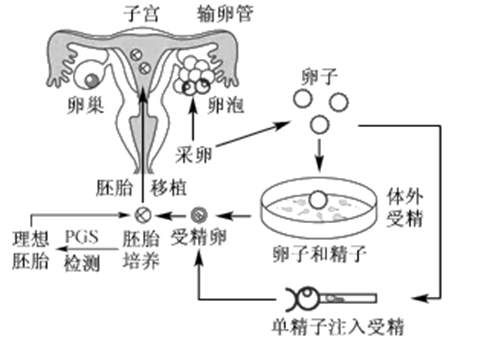 人工代孕