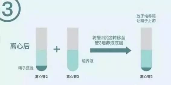 人工授精