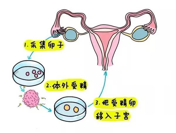 人工授精需要