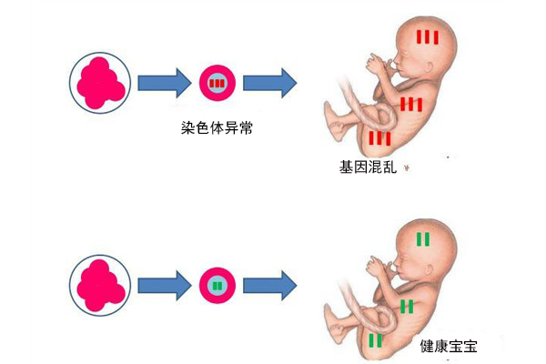 人工授精